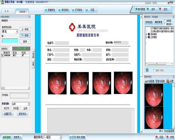 供應(yīng):膀胱鏡影像工作站