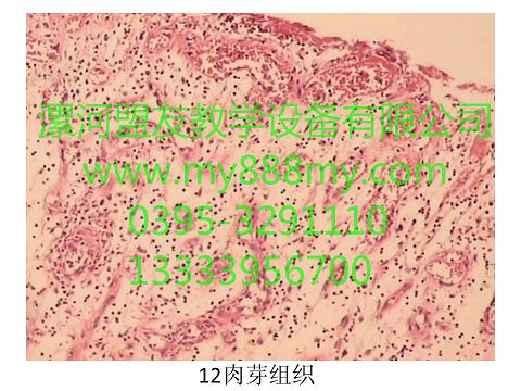 供應病理切片-圖為肉芽組織