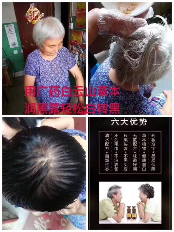廊坊供應**捷護美草本潤黑露   |草本潤黑露廠家電話