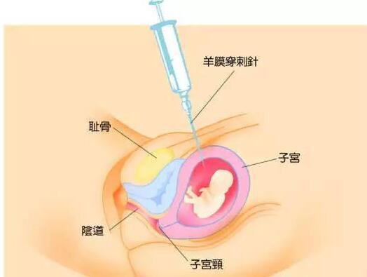 廈門上海dna親子鑒定 上海