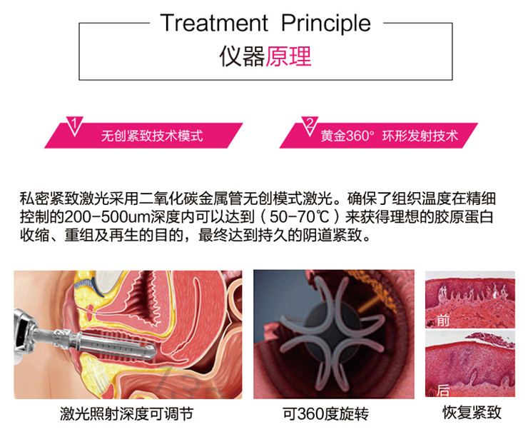 **脉冲CO2点阵激光仪器厂家