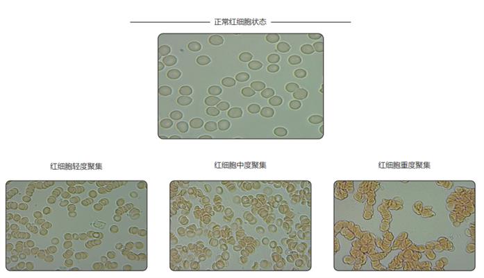 泉州EIS红细胞影像系统报价