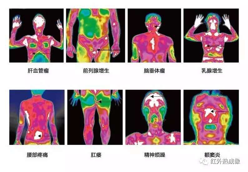 南阳医用红外热像仪厂家