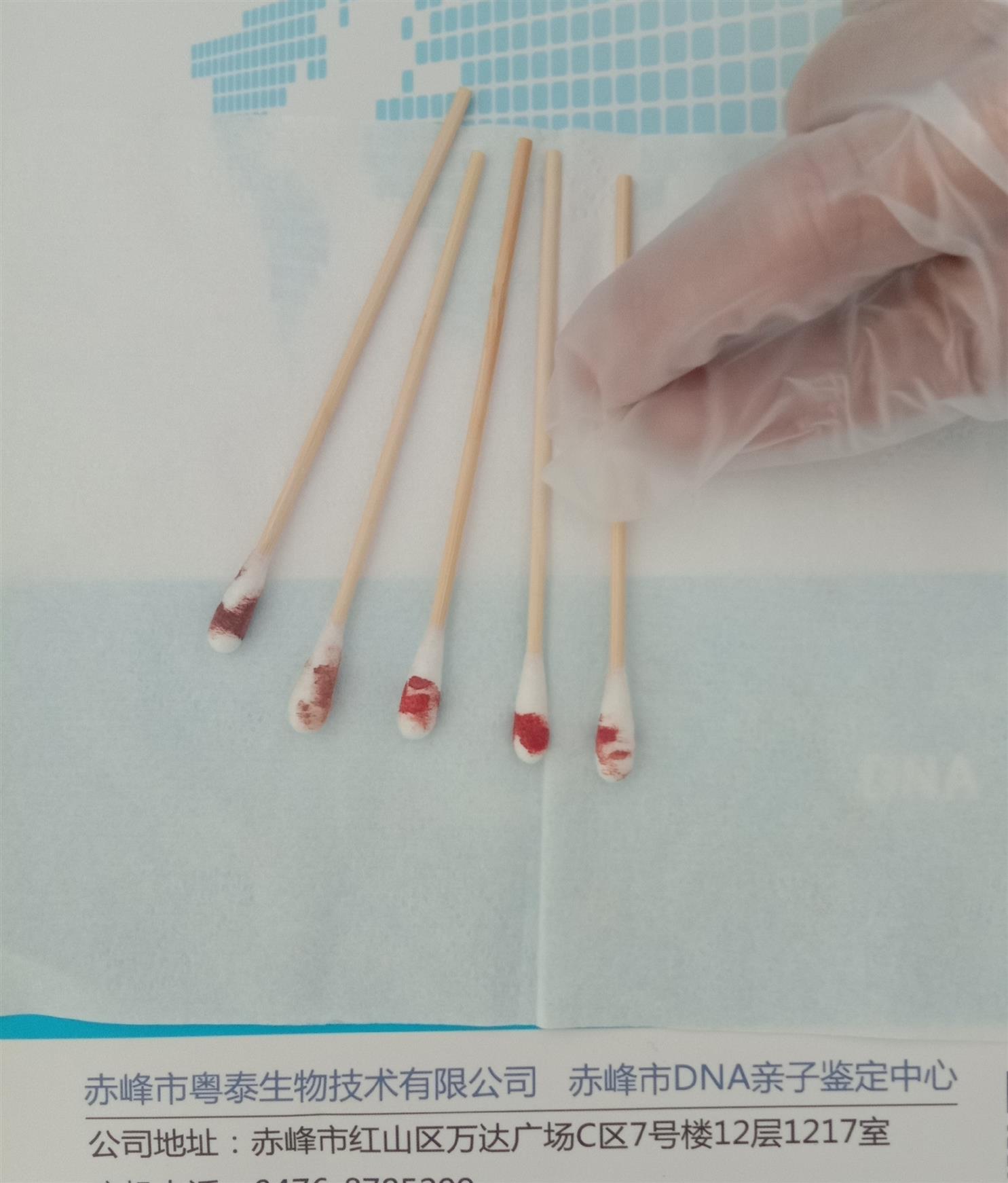 呼和浩特產前胎兒親子鑒定_信賴