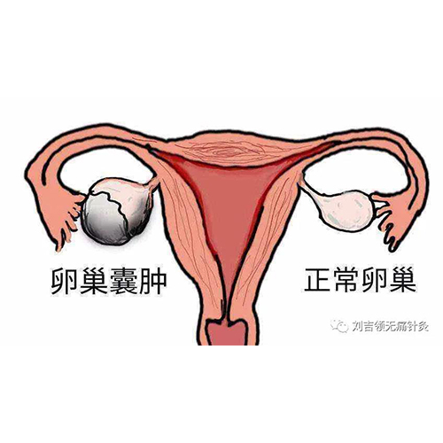防城港劉吉領(lǐng)中醫(yī)陰陽(yáng)消瘤班培訓(xùn) 甲狀腺結(jié)節(jié)針灸