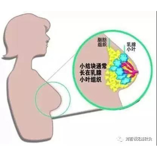 標(biāo)本同治 張家口劉吉領(lǐng)中醫(yī)陰陽(yáng)消瘤班培訓(xùn)