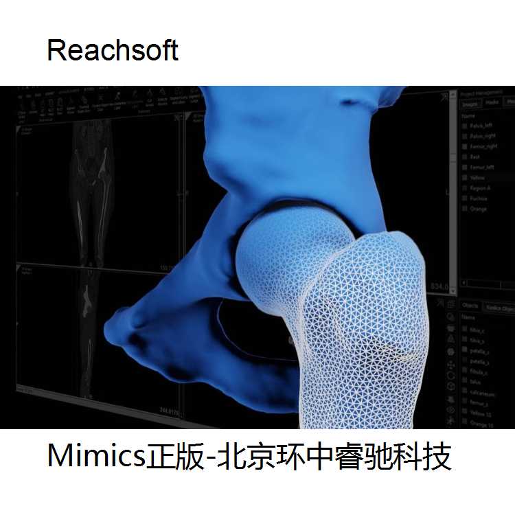 正版Mimics工具介绍