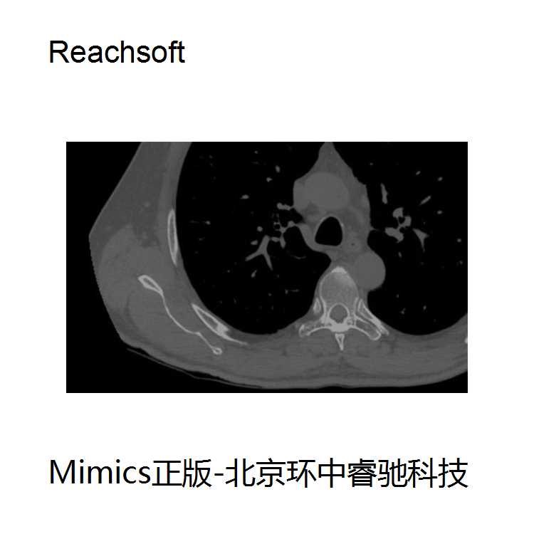 医学数据处理软件