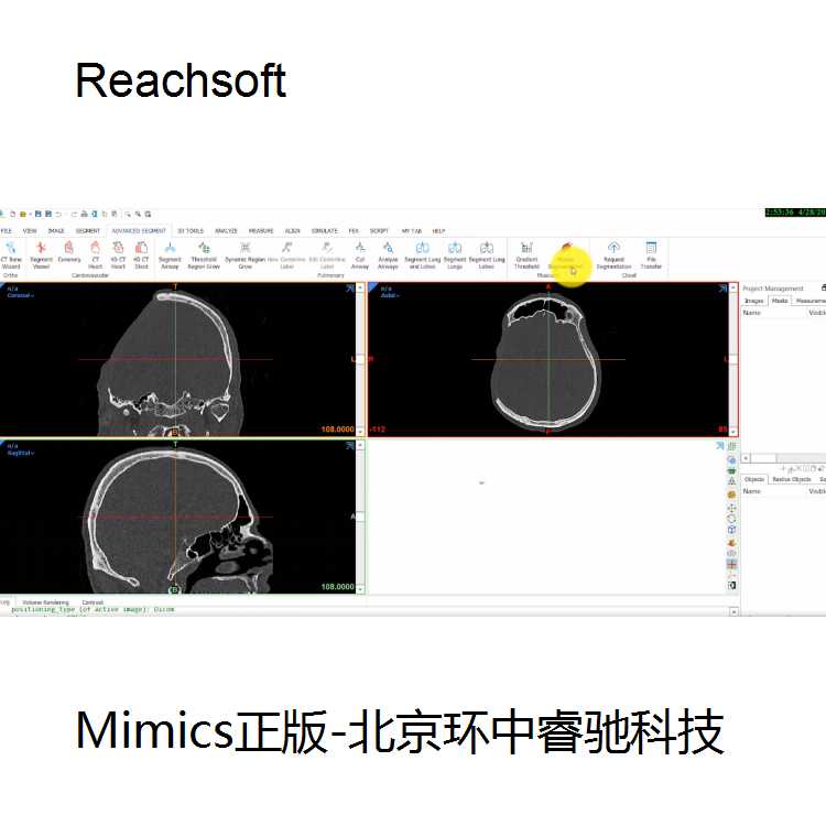 Mimics操作手册