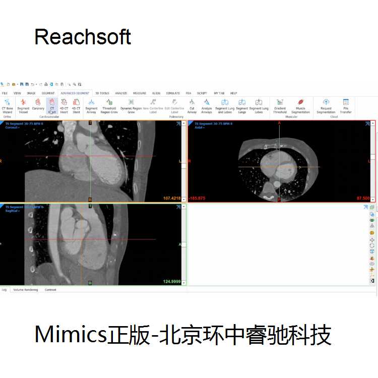 mimics导入dcm文件