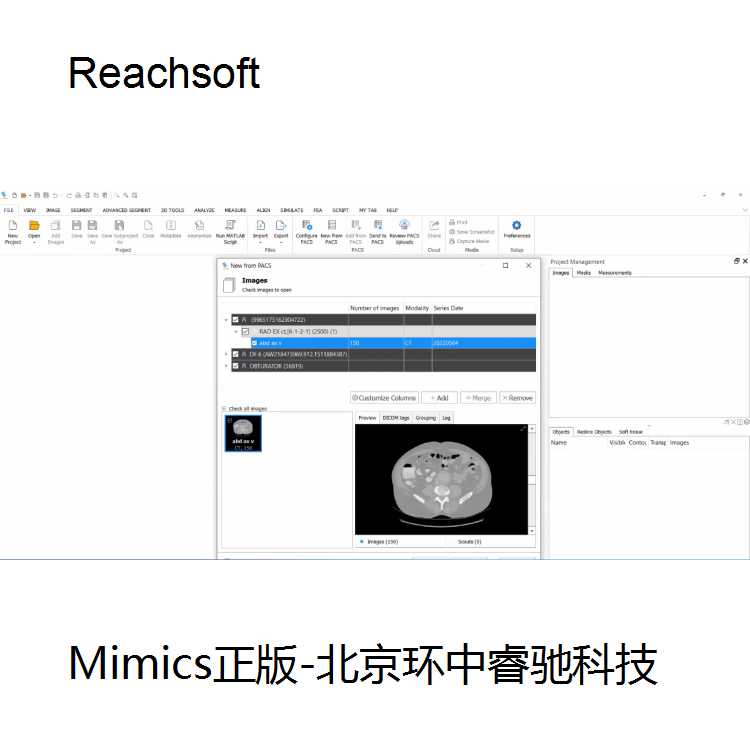 医学3D成像软件Mimics