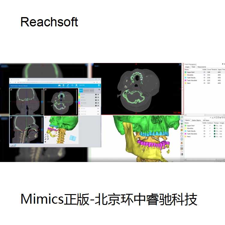 mimics导入dcm文件