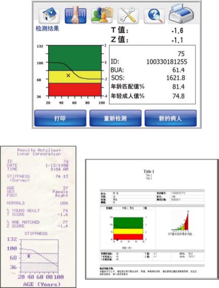 台州GE Achilles EXPII超声骨密度仪型号