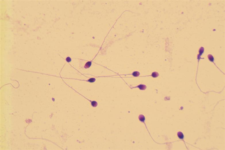 北京精子涂片实现全覆盖浸染