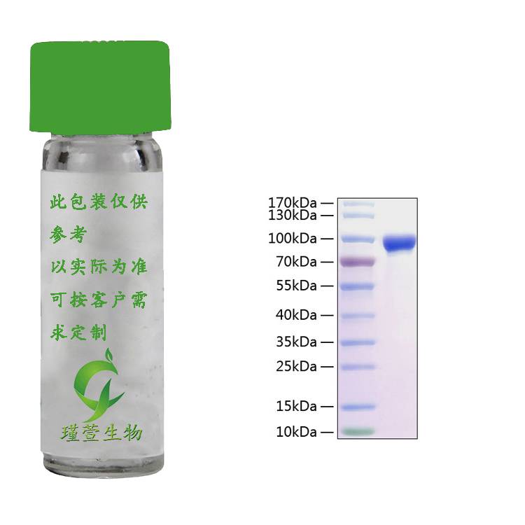 Active Recombinant Rat MMP-9 Protein 重组蛋白 动物活性