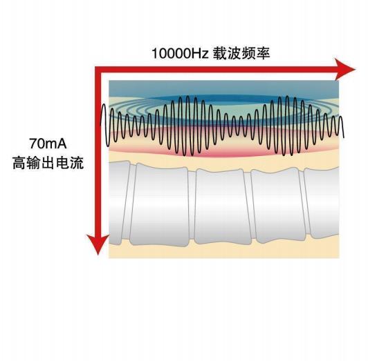 天水由企画中频治疗仪IFC α1配件