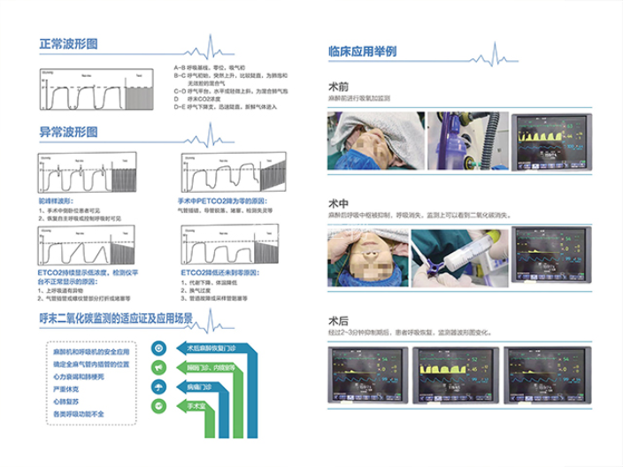 福建呼气末二氧化碳检测采集型吸氧管生产厂家,吸氧管