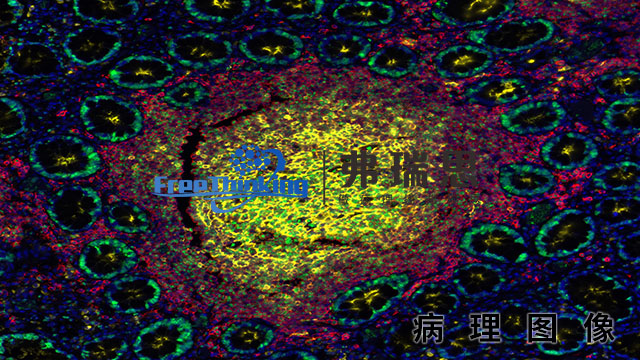 鎮江多色*熒光病理圖像分析 南京弗瑞思生物科技供應