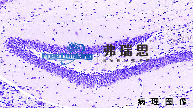 汕尾組織芯片病理圖像實驗流程 南京弗瑞思生物科技供應