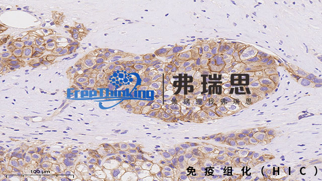 珠海組織芯片*組化分析 南京弗瑞思生物科技供應(yīng)