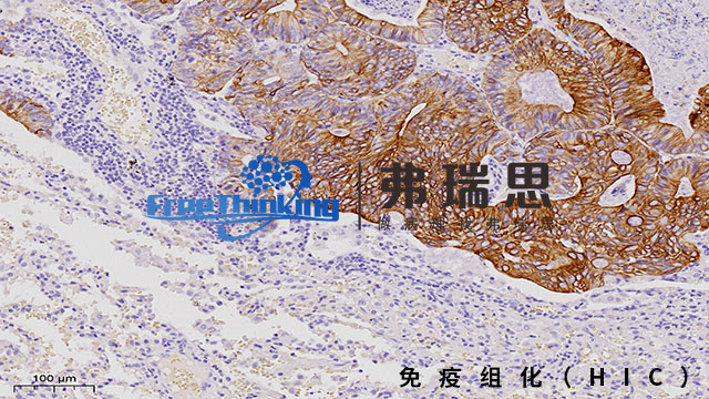 舟山組織芯片*組化分析 南京弗瑞思生物科技供應(yīng)