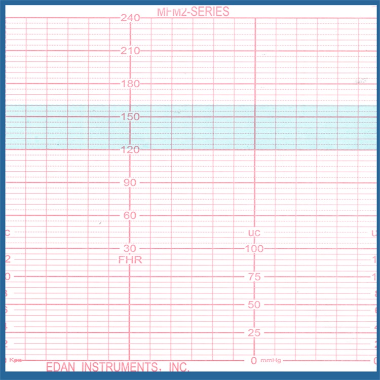 西安胎心仪打印纸