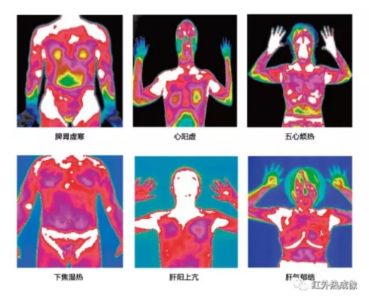 天津医用红外热像仪