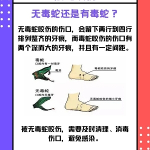 西湖区小区防蛇